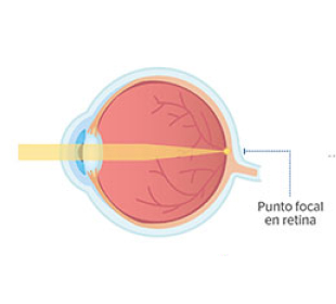 ojo normal sin presbicia